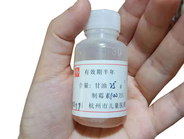 寶寶嘴里長(zhǎng)了白色斑點(diǎn)，很可能是鵝口瘡